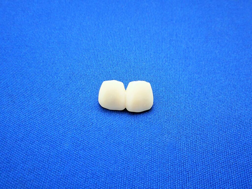 前歯の治療に使用する被せ物