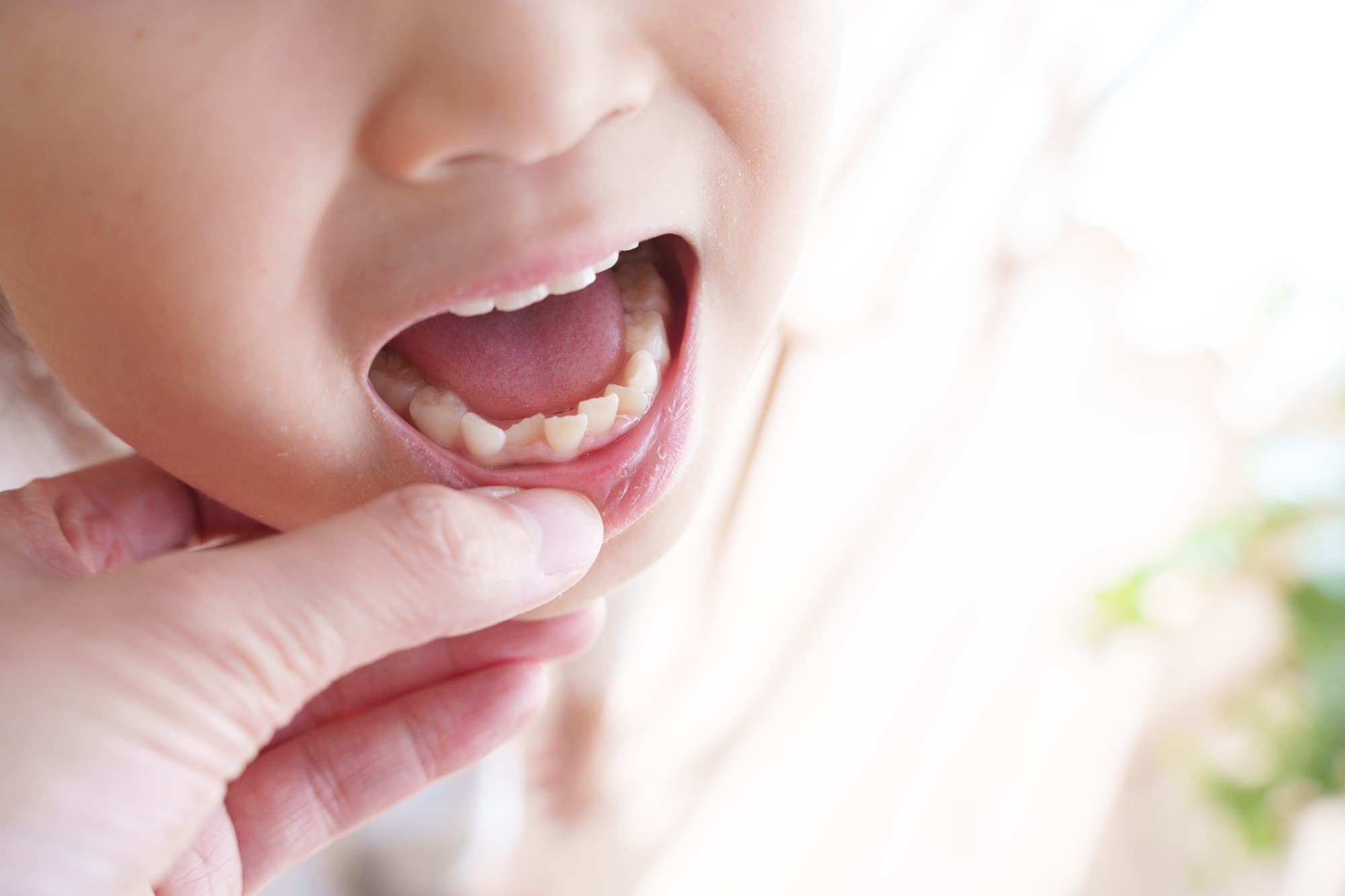 子どもの歯並びが気になる！歯並びが悪いまま放置するリスクも