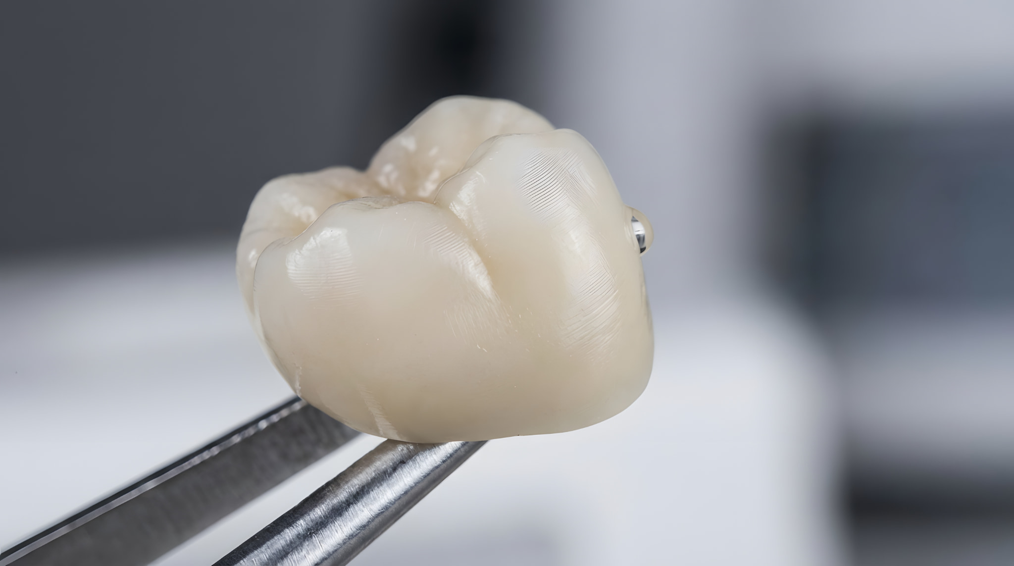 奥歯に使用するセラミックの被せ物