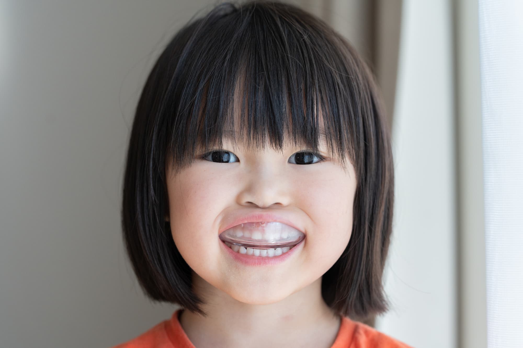 プレオルソで歯の矯正をする女の子