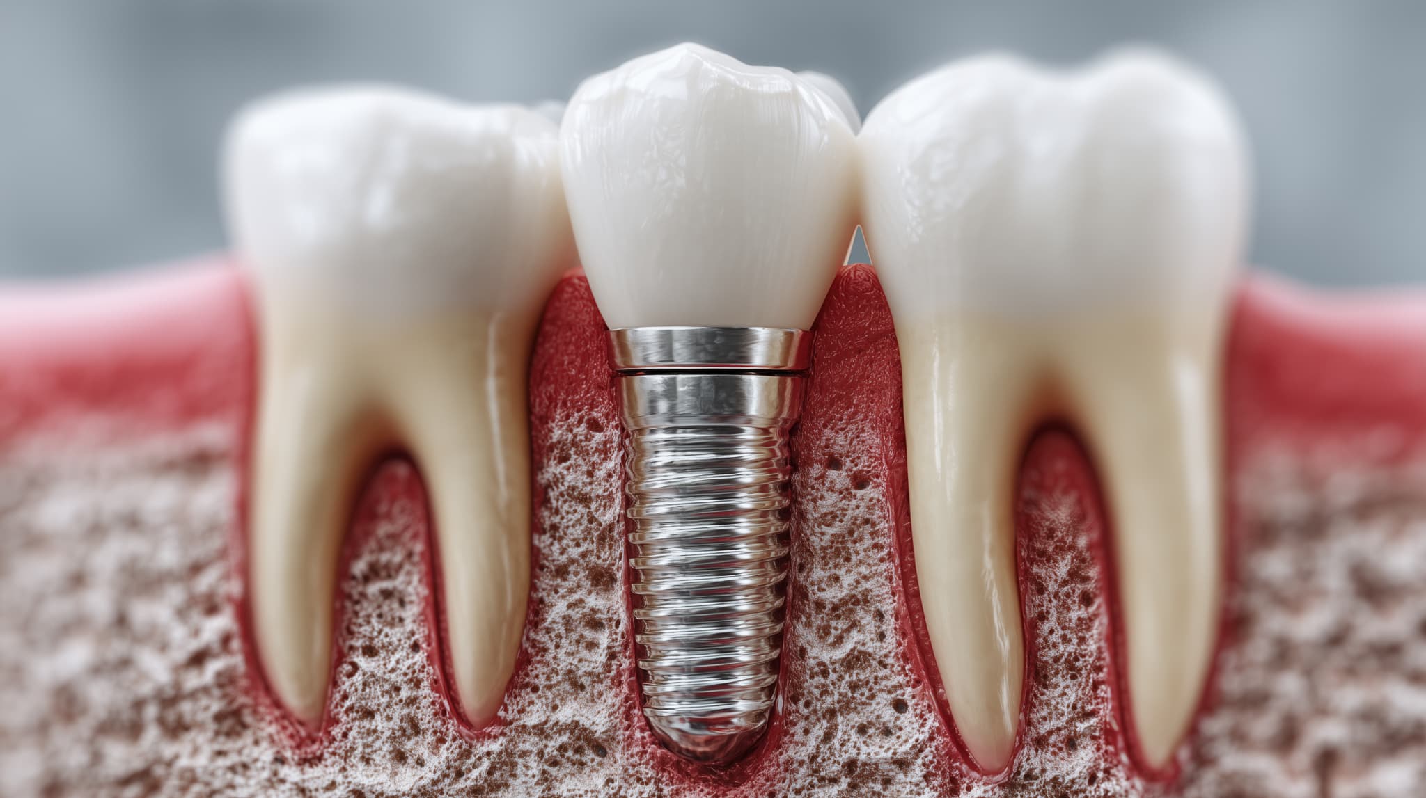 口臭の原因はインプラントかも？お口の中を清潔に保つ方法も